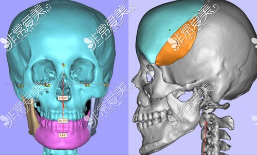 3D輪廓掃描