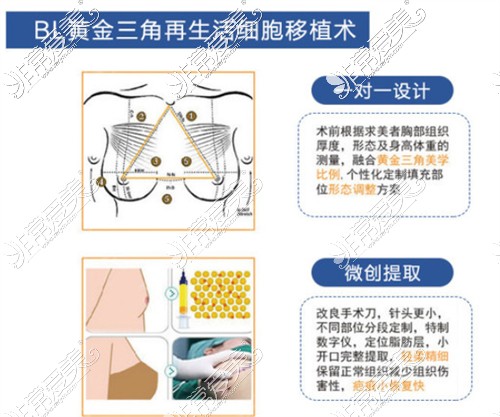 武汉同济医学院医院隆胸技术