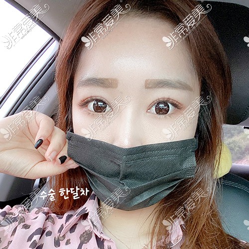 韩国icon整形医院双眼皮手术