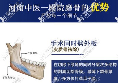 下颌角皮质骨去除手术