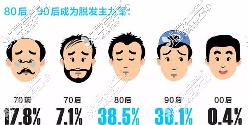 80后、90后成为脱发主力军