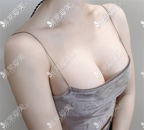 兰州韩美医疗整形美容脂肪隆胸风格