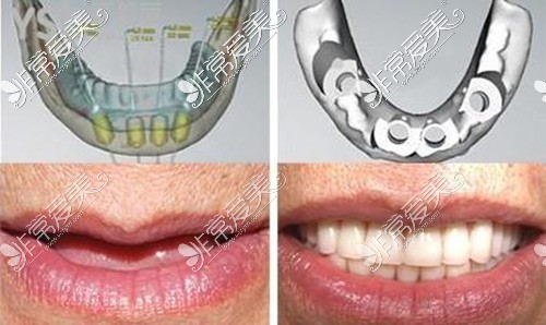 贵阳牙科医院哪家收费便宜?盘点价格合理且实惠的正规医院