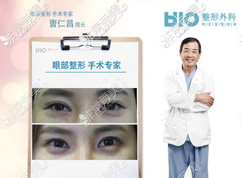 韩国双眼皮出名的医院汇总 排行靠前割双眼皮厉害的都在内