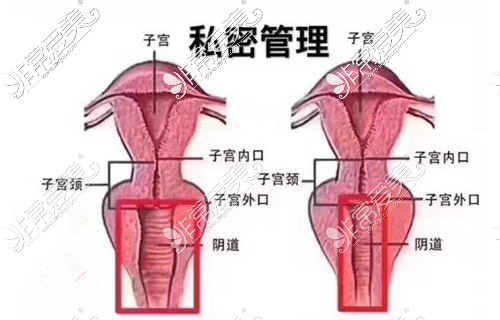 私密整形示意图