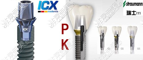 德国ICX种植牙示意图