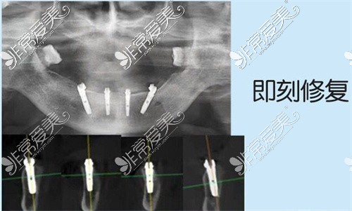 福建省牙科医院排行名单公布,均为福州牙科医院排行前10!