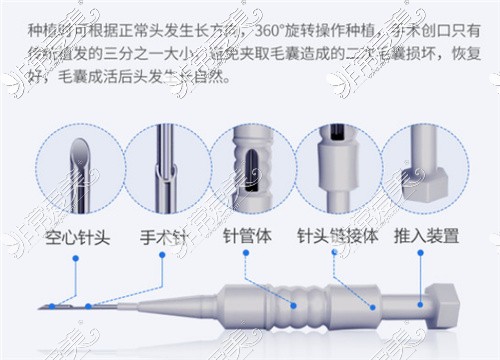 十大植发正规医院排行，揭秘国内植发机构前10强哪家好！