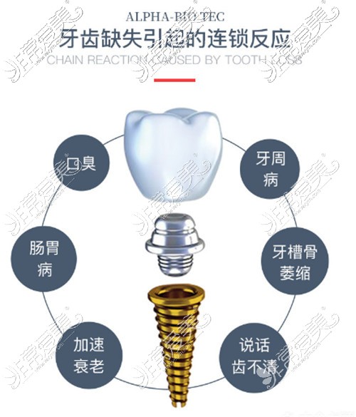 牙齿缺失危害