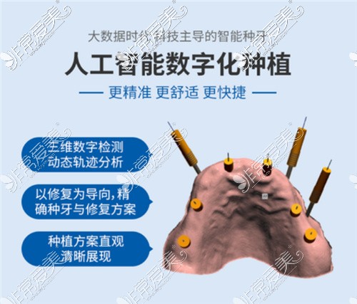 广州免费种植牙是真的吗？广州种牙可以用医保吗？