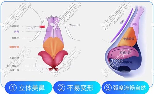 佛山隆鼻整形医院哪里好?佛山隆鼻整形靠谱医院汇总!