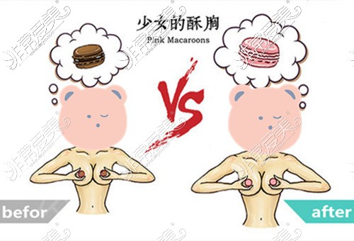 乳晕漂红前后颜色