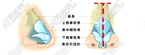 鼻整形内部结构