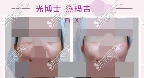 重慶光博士整形醫(yī)院熱瑪吉