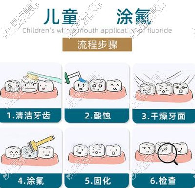 儿童口腔涂氟改善卡通图