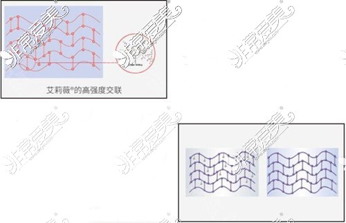 艾莉薇玻尿酸