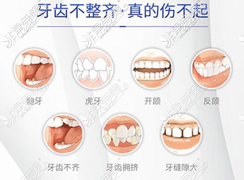 哪些牙齿需要进行矫正