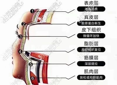 热玛吉治疗图