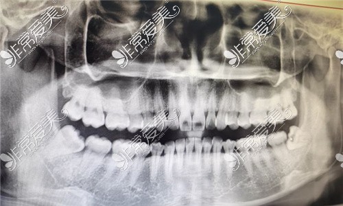 福州貝臣口腔牙片