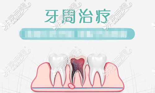 西安林牙立齿口腔牙周治疗