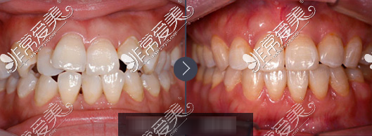 南京華美口腔牙齒矯正