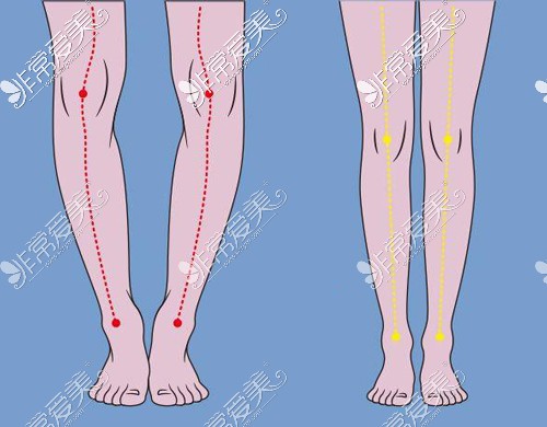 常见分开腿型和笔直腿型