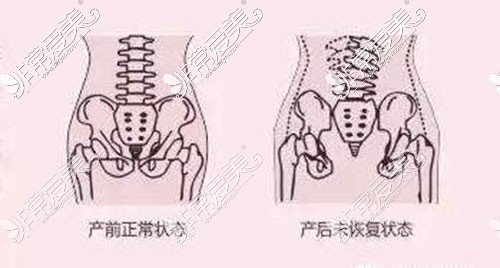 产前产后状态