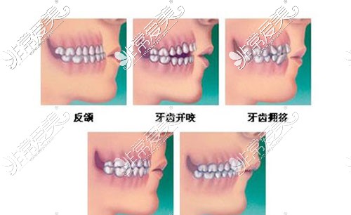 重庆金航口腔医院牙齿矫正