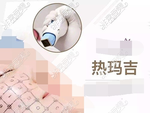 贵阳热玛吉示意图