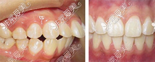 濰坊可恩口腔醫(yī)院牙齒矯正