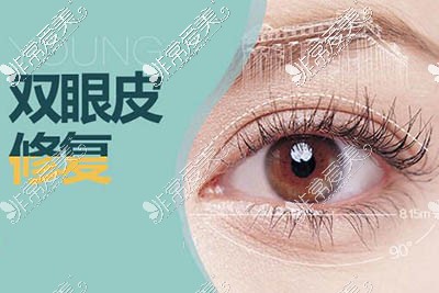双眼皮修复上海哪里做得好