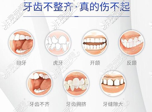 哪些牙齿需要进行正畸改善