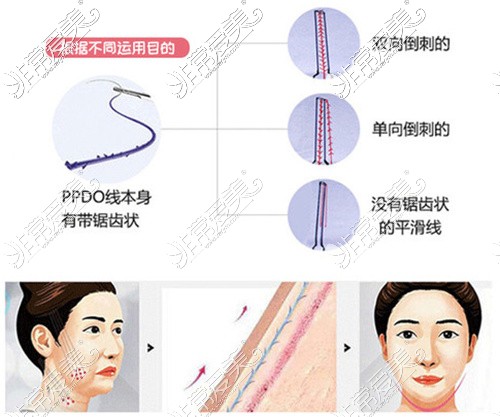 贵阳美贝尔医疗美容提升