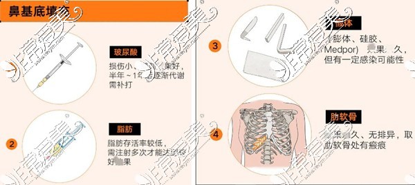 鼻基底凹陷用什么填充好