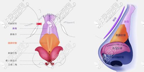 鼻整形手术方式示意图