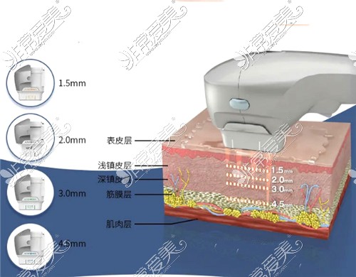 7d聚拉提不同作用层次