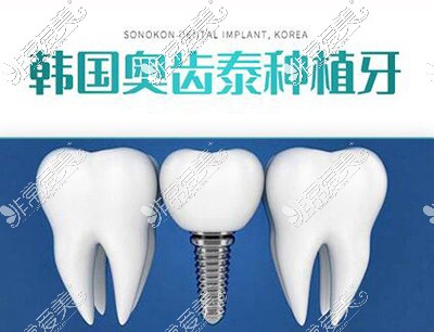 韩国奥齿泰种植牙卡通图