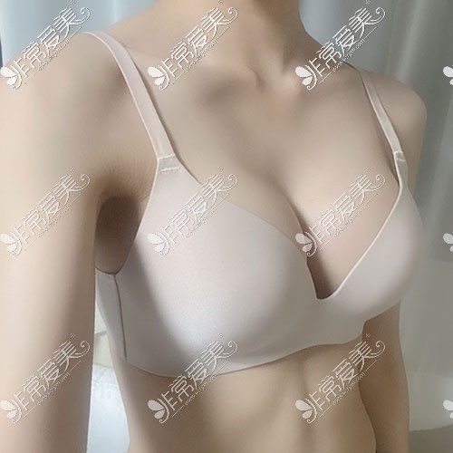 韩国U＆U整形外科隆胸照片