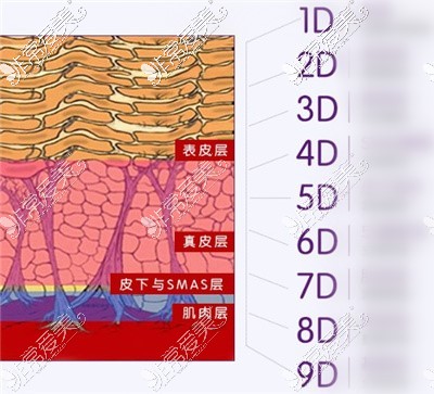 9d面部提升術(shù)原理解釋