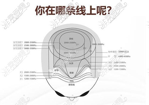 植发卡通图照片改善