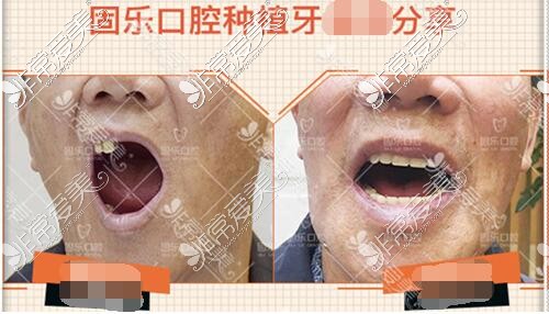 郑州固乐口腔医院怎样