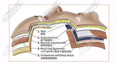 面部拉皮提升部位解剖层次