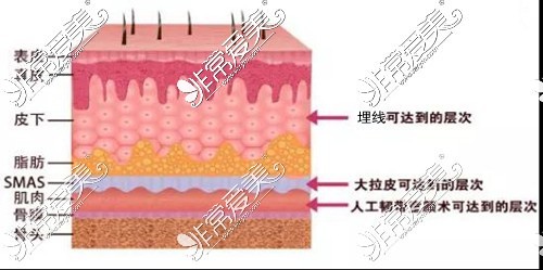 7D聚拉提作用深度