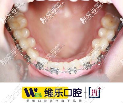 上海维乐口腔牙齿矫正