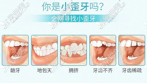 哪些牙齿需要进行矫正改善
