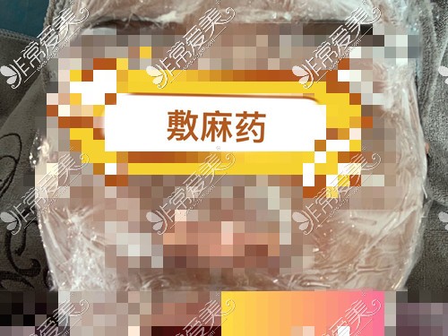 佳木斯抗衰除皱比较好的医院！曝光韩艺来抗衰除皱价格表