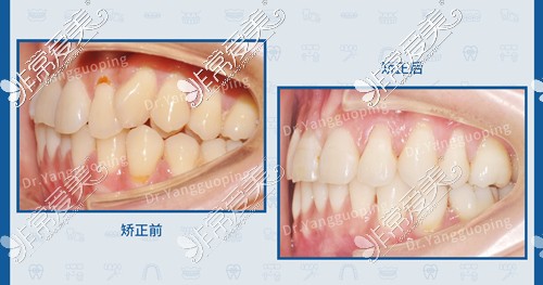 上海维乐口腔杨国平医生1