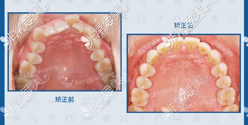 上海维乐口腔杨国平医生3