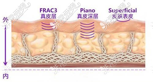 贵阳激光拉皮除皱哪家医院好？除皱一次多少钱维持多久