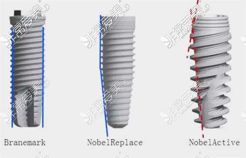 不同型号诺贝尔种植牙